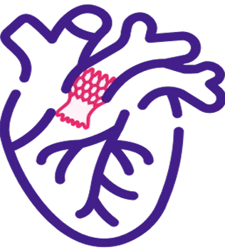 Transcatheter Aortic Valve Replacement icon